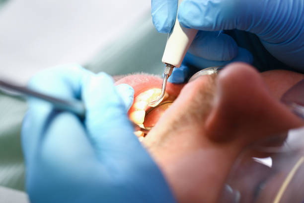 Best Emergency Pediatric Dental Care in West Falls Church, VA
